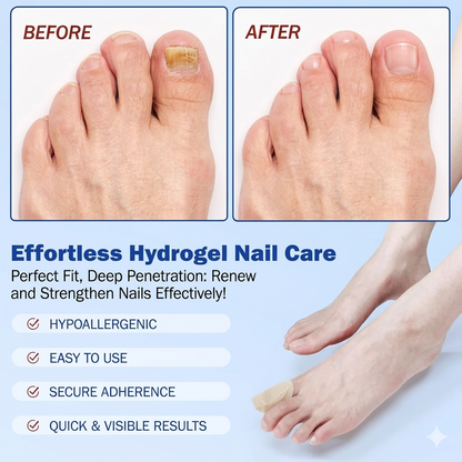 Reusable Fungal Nail Treatment Patches